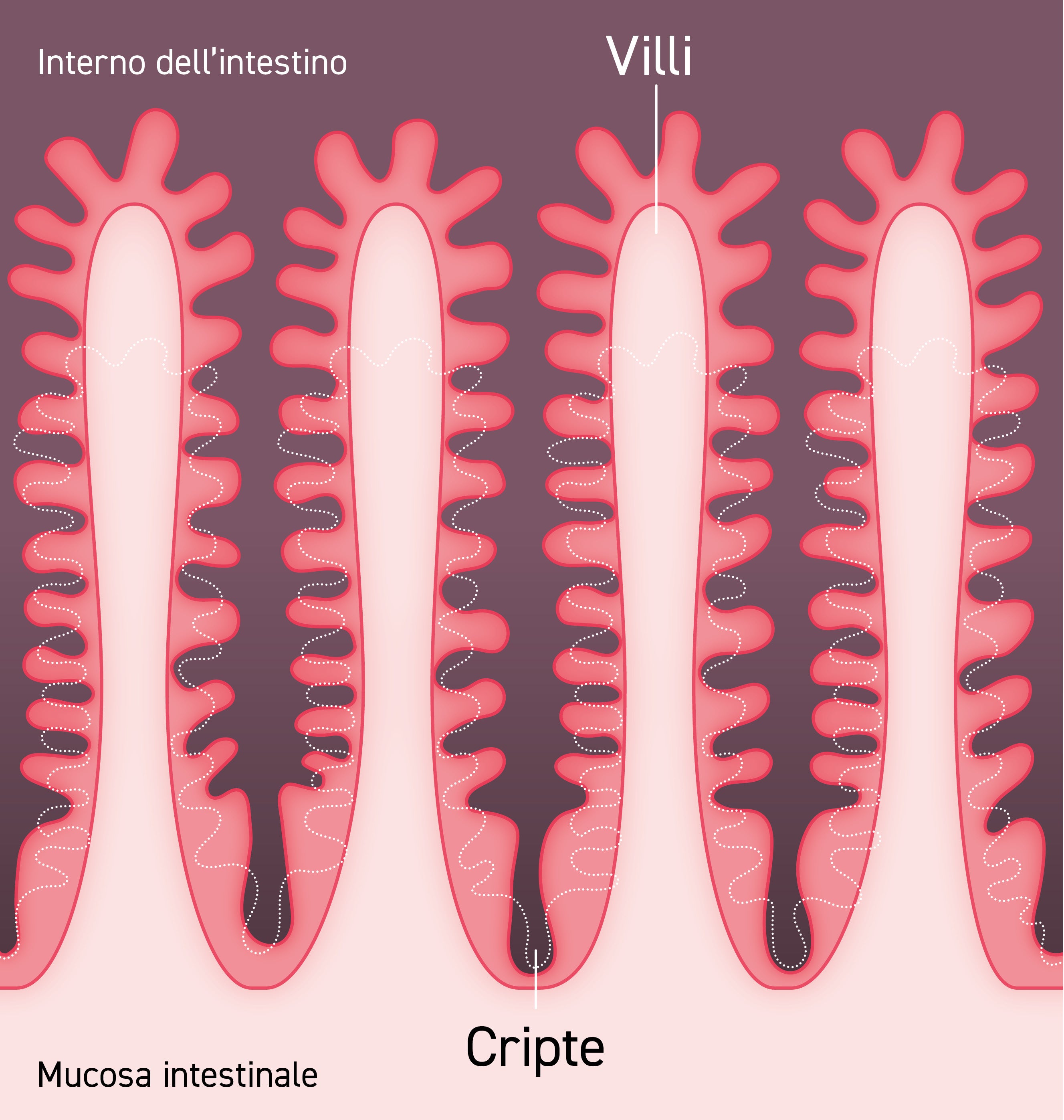 La terapia ormonale GLP-2 puÃ² estendere la superficie della mucosa aumentando la lunghezza dei villi e la profonditÃ  delle cripte. In questo modo si ottiene il miglioramento della capacitÃ  dellâintestino di assorbire i nutrienti anche in una sezione intestinale ridotta.